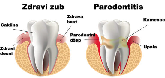 parodontologija