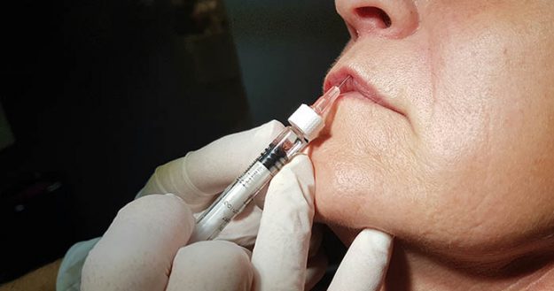 botox fileri-botox