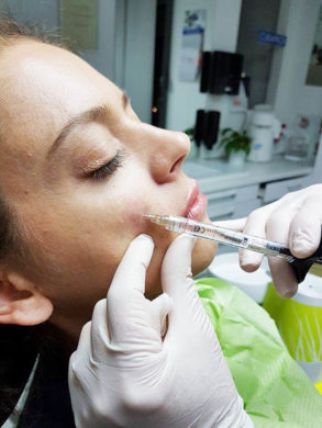 fileri-botox