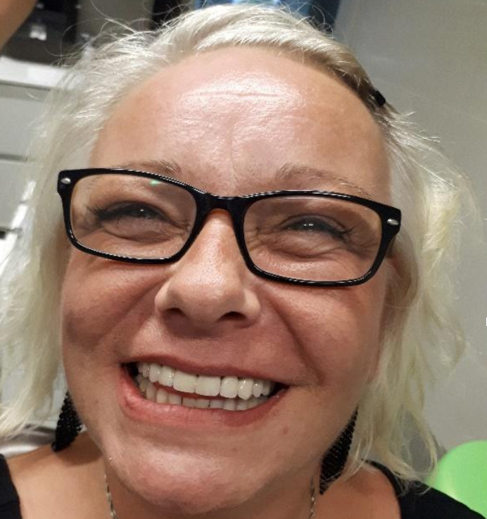 zubne proteze
