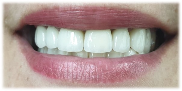 dental mimica 2